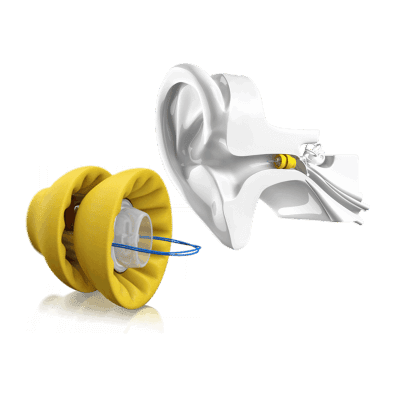 Lyric hearing aids